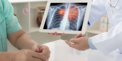 lung-cancer-treatment-in-Delhi