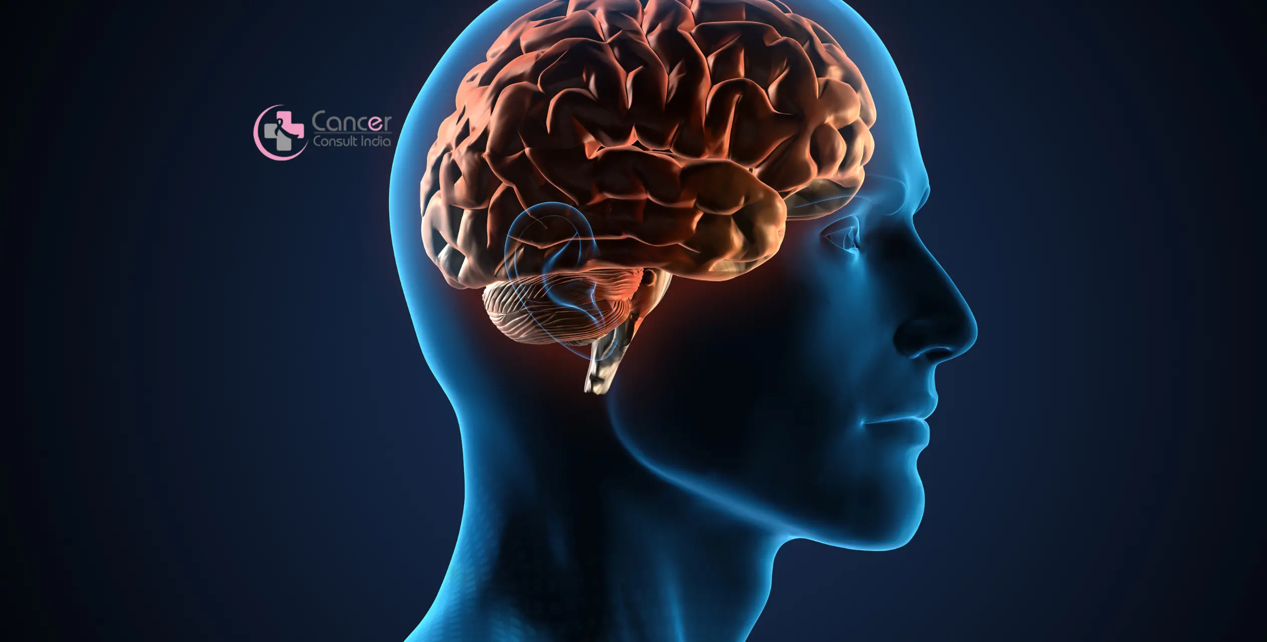 6 Warning Signs of Brain Cancer You Shouldn't Ignore