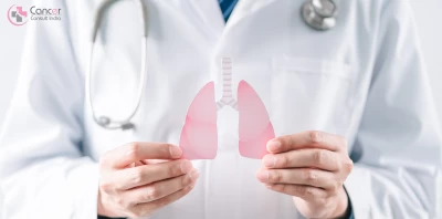lung cancer doctor in Noida11111