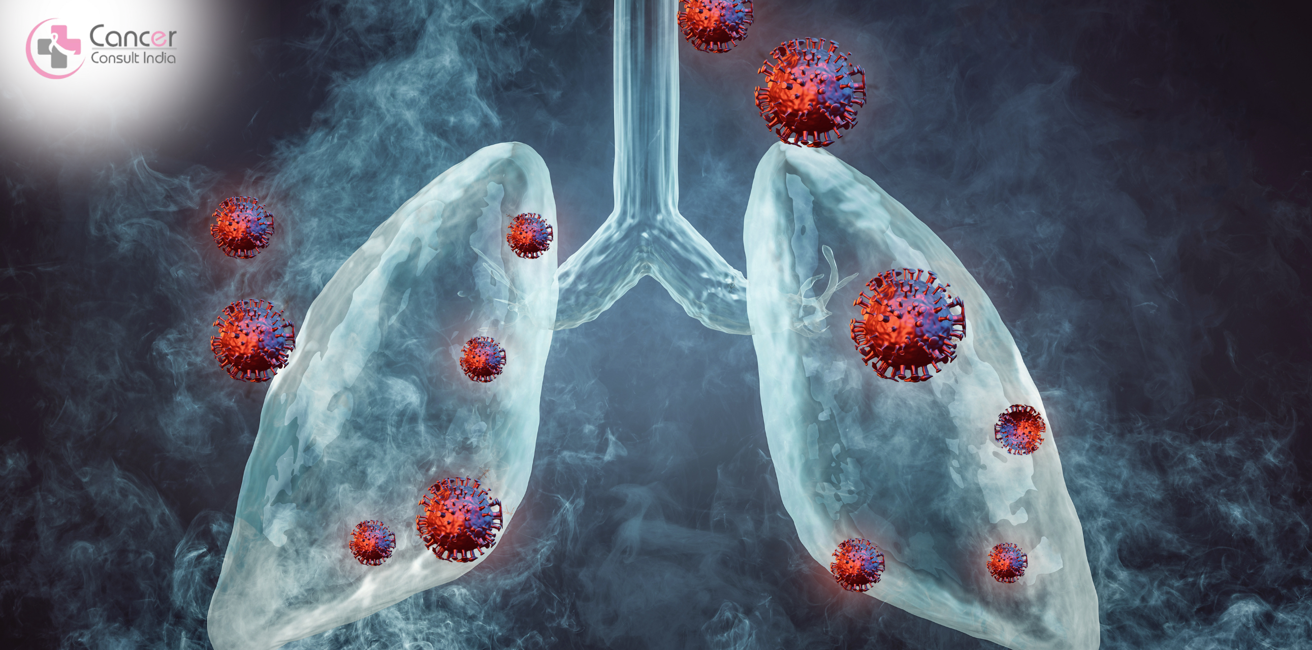 What Are The Common Type Of Lung Cancer?