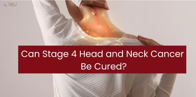 Can Stage 4 Head and Neck Cancer Be Cured