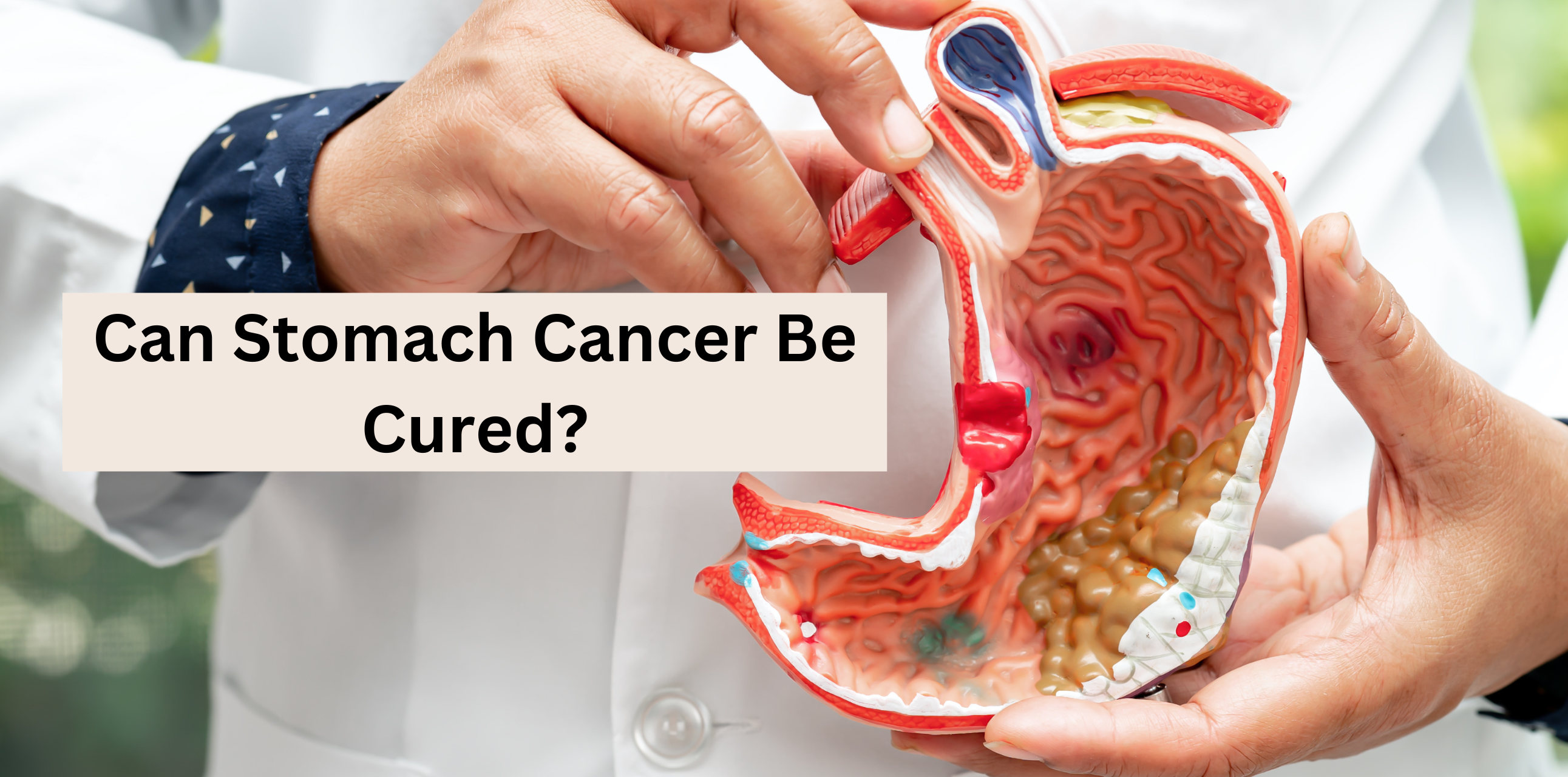 Can Stomach Cancer Be Cured?