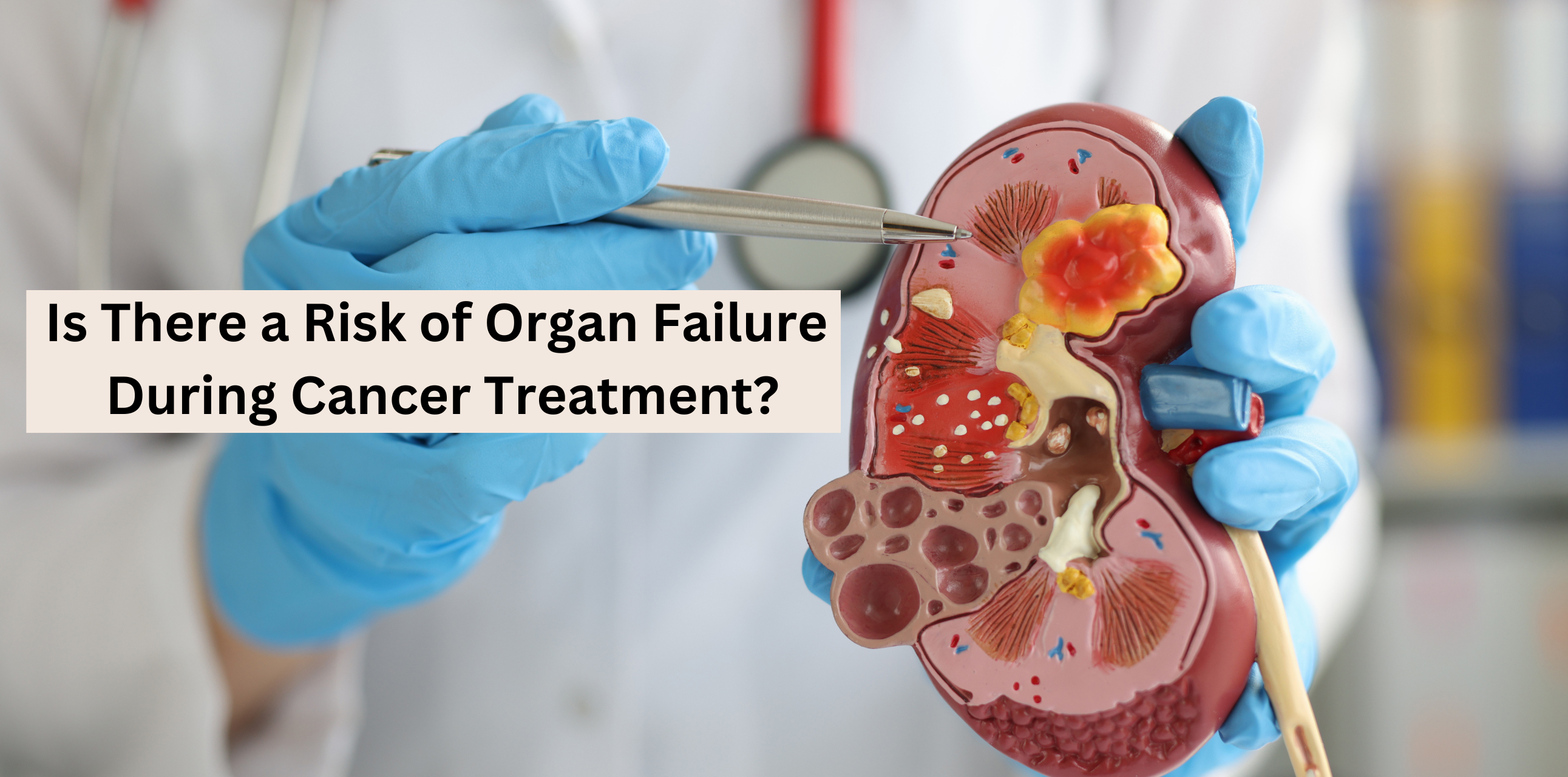 Is There a Risk of Organ Failure During Cancer Treatment?