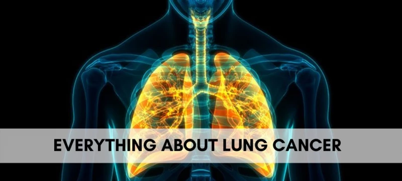 Lung Cancer Awareness: Things Everyone should know about Lung Cancer