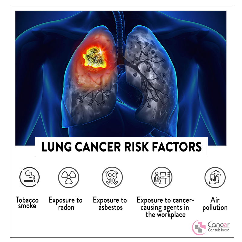 Best Treatment For Lung Cancer in Noida | Dr. Manish Singhal
