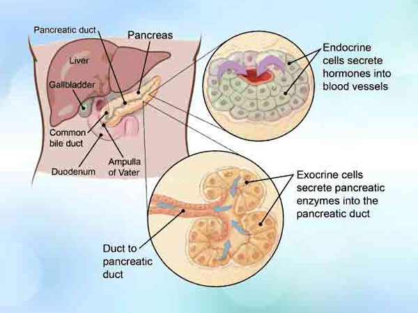 Types of Pancreatic Cancer